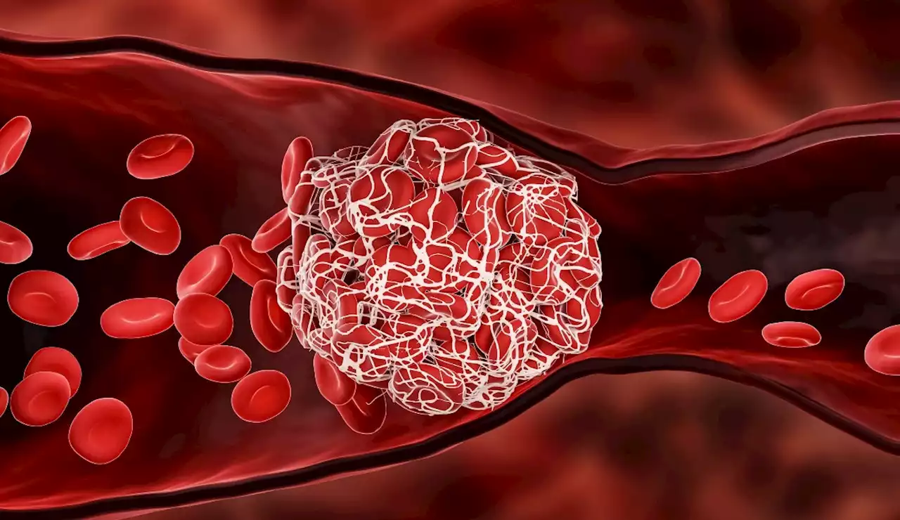 Population-wide cohort study detects increase in major arterial and venous thrombotic events immediately after COVID-19 diagnoses