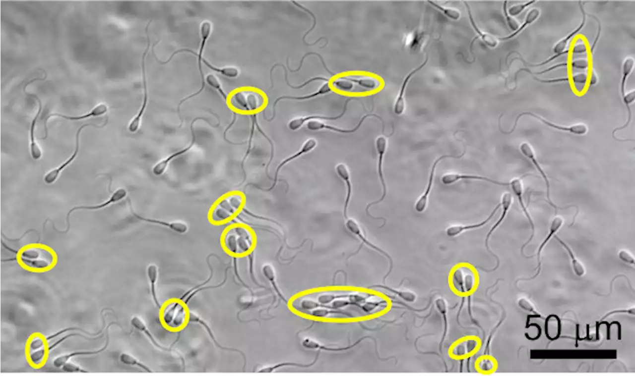 Teams of sperm swim more smoothly against the current