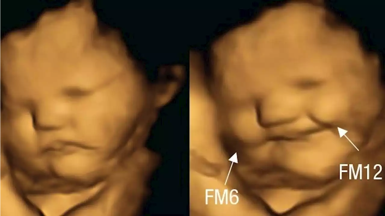 Fetuses grimace over kale, but smile for carrots, small study finds