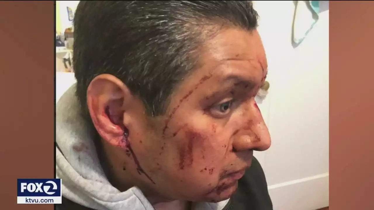 Police search for man who brutally attacked father in San Francisco's Mission