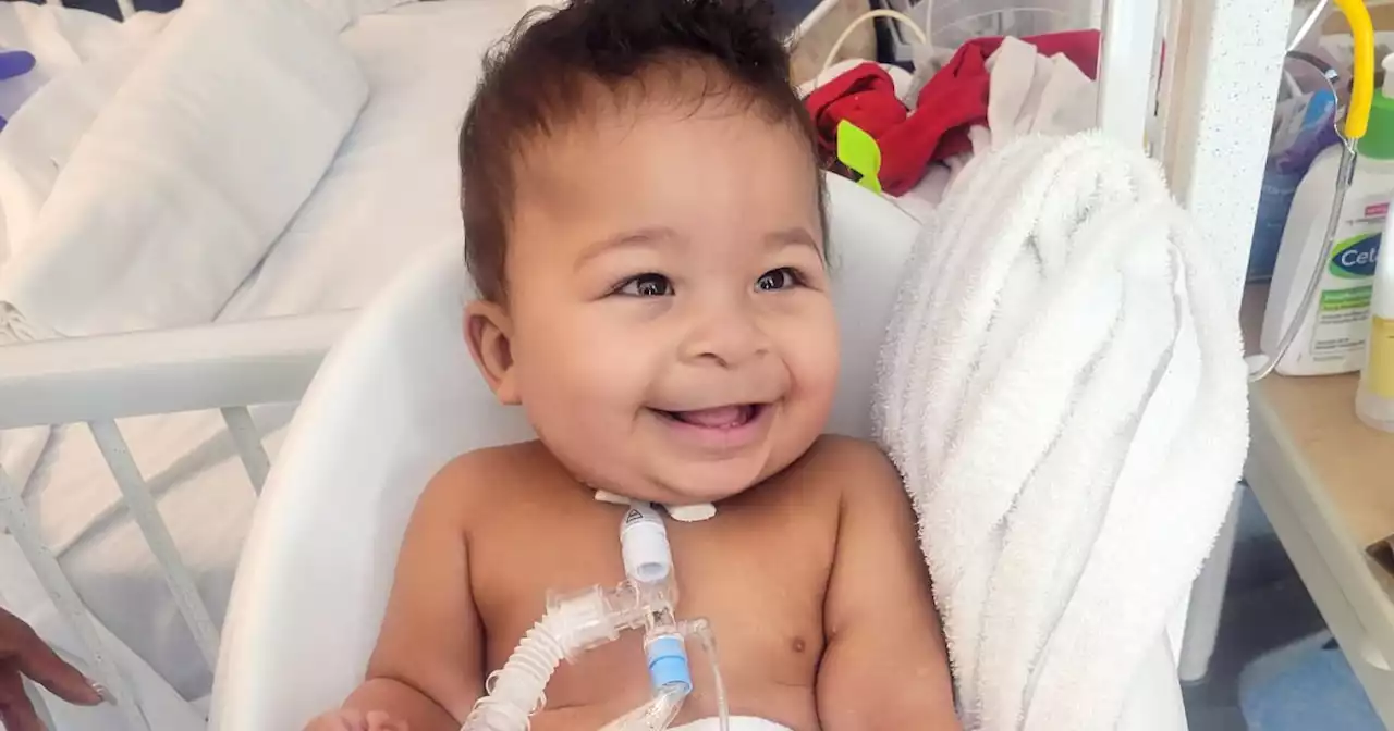 Baby with rare, fatal condition called CHAOS survives thanks to surgery mid-birth