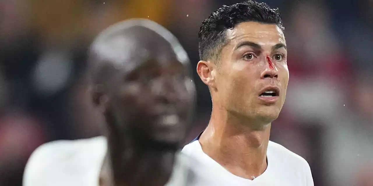 Daftar Pemain Top yang Terkena Virus FIFA: Cristiano Ronaldo Berdarah-Darah, Barcelona Menderita Paling Parah! - Bola.net