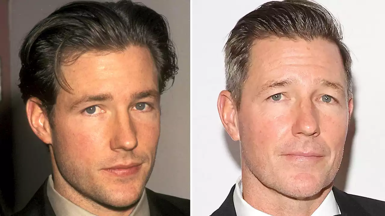 Edward Burns -- Good Genes Or Good Docs?!