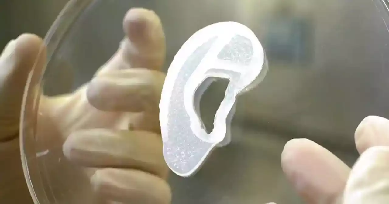 Doctors Transplant Ear That Was 3D Printed With Patient's Own Cells