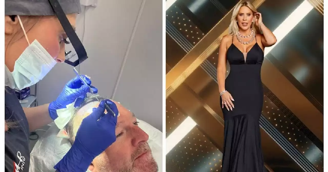 Real Housewives star treats partner to hair transplant for his birthday