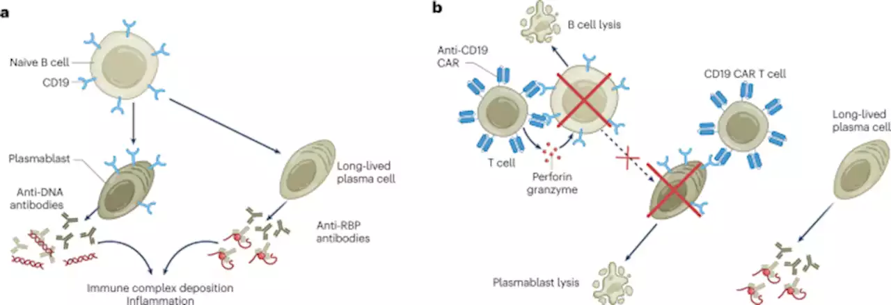 Arming T cells against B cells in systemic lupus erythematosus - Nature Medicine