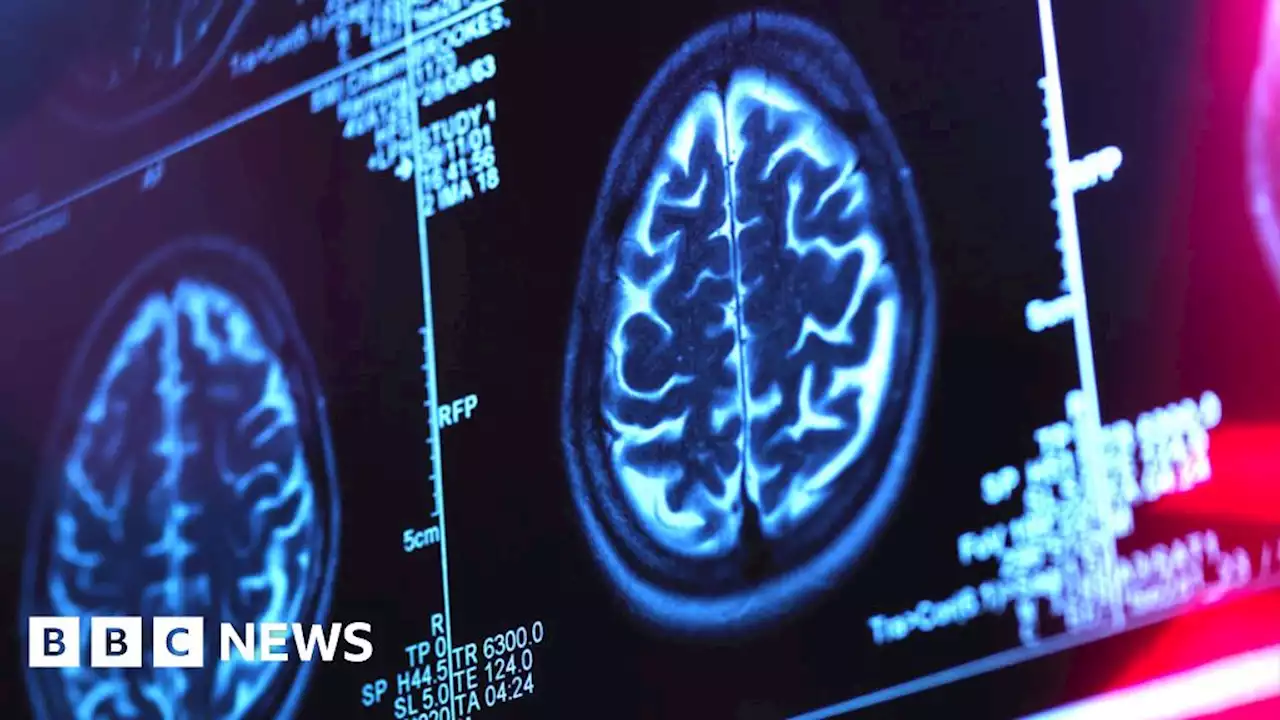 Alzheimer's-slowing drug labelled historic