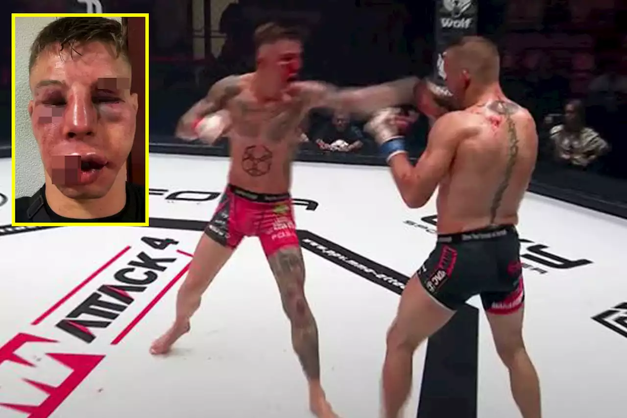 MMA rivals unrecognisable as both their faces badly swell after bloody brawl