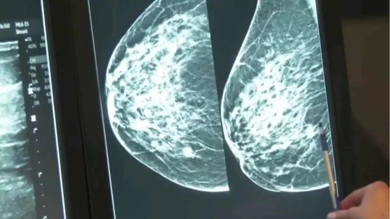 Mobile mammography service coming to Cochrane