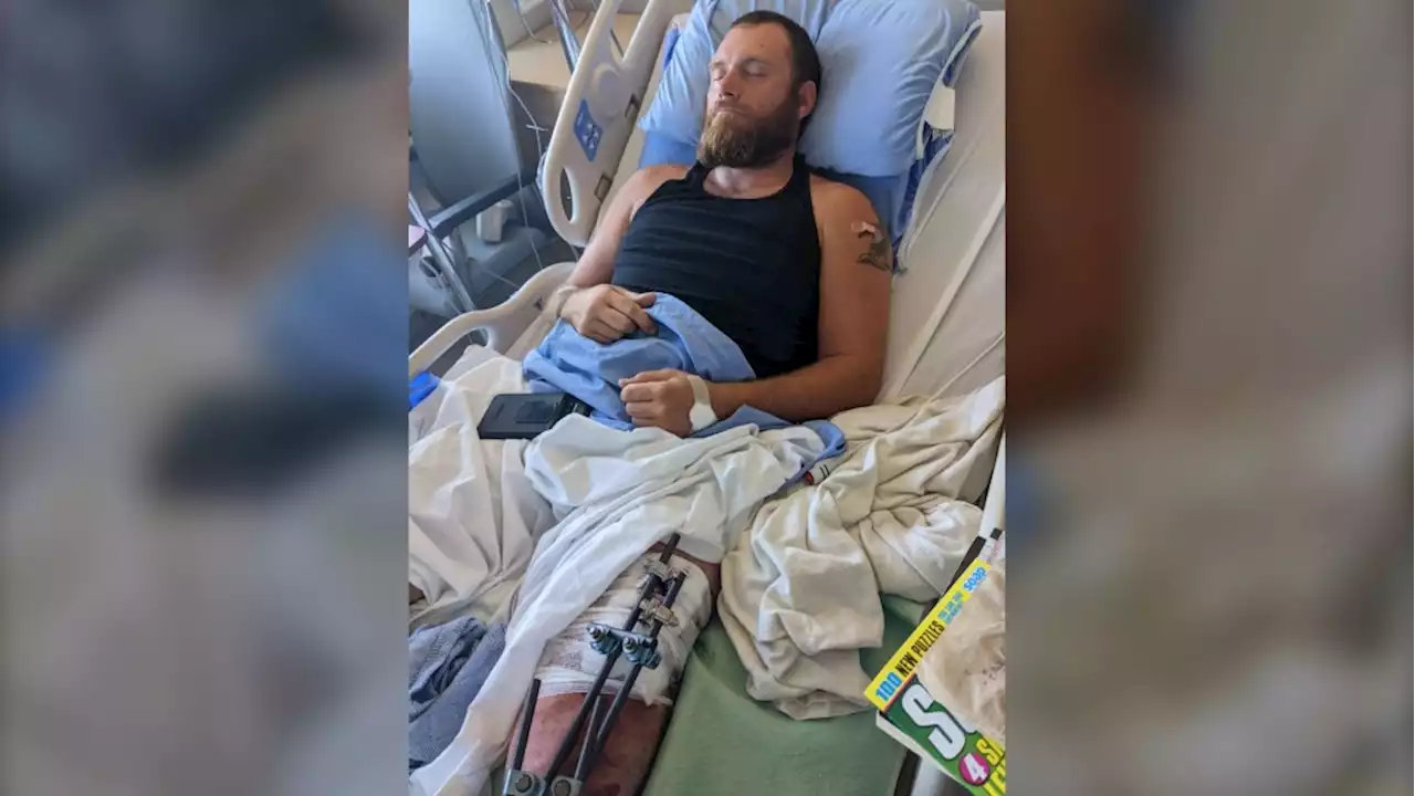 Ontario man 'lucky to be alive' after being run over by car in a road rage incident