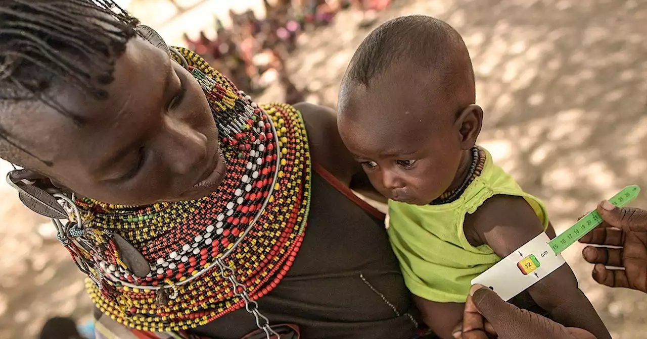 En fotos: la sequía agrava la hambruna en Kenia, más de 942.000 niños sufren desnutrición aguda