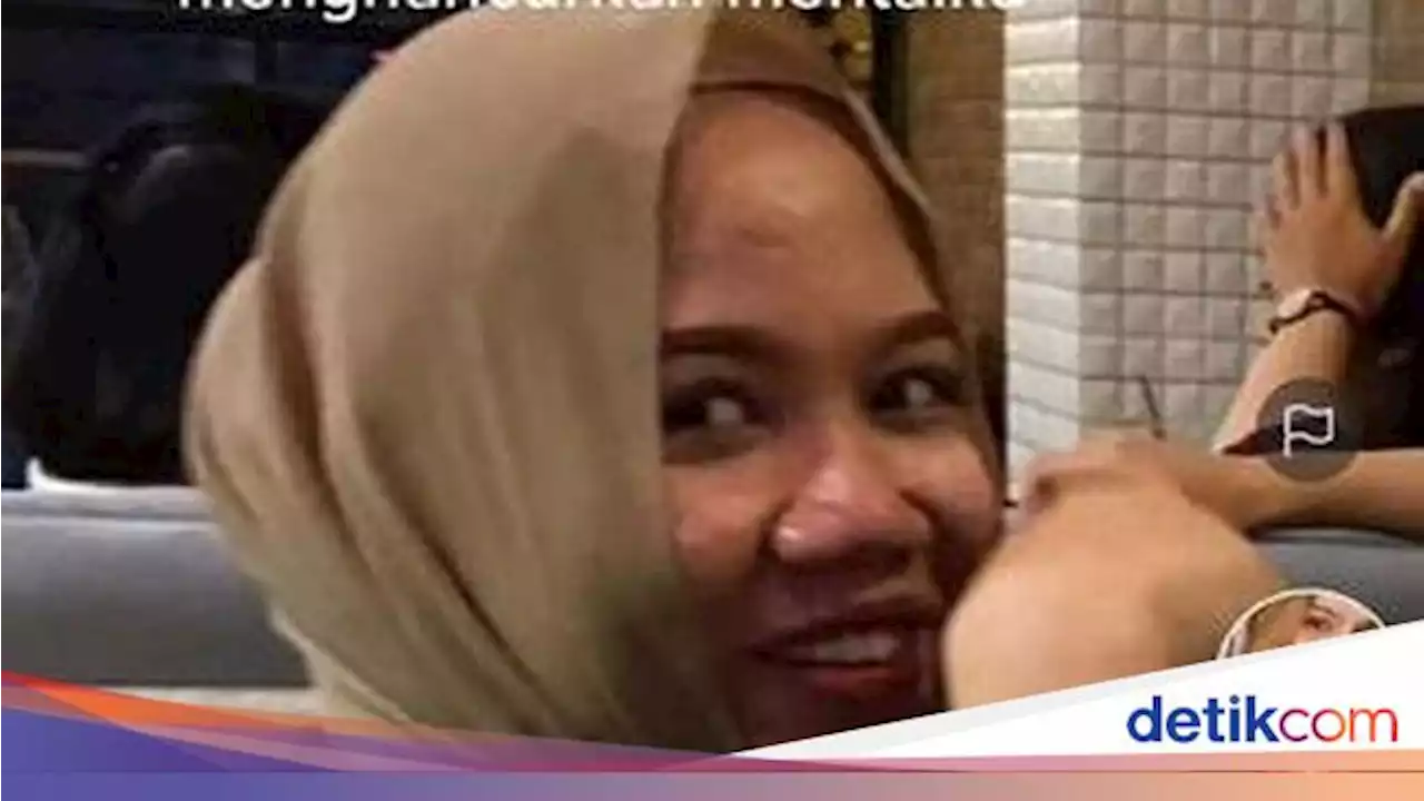 Viral Transformasi Wanita RI yang Operasi Plastik, Before After Bikin Kaget