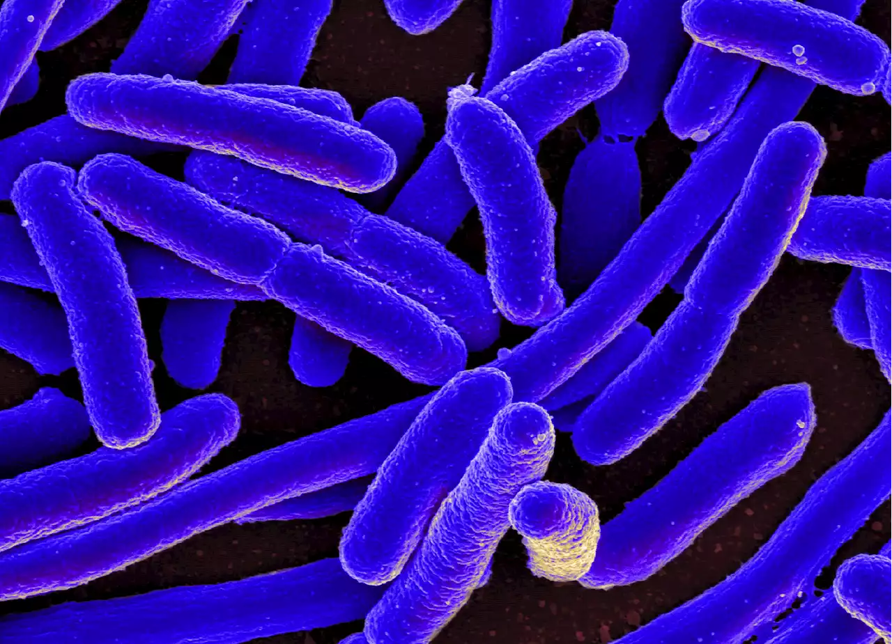 E. Coli Outbreak Extends to New York and Kentucky