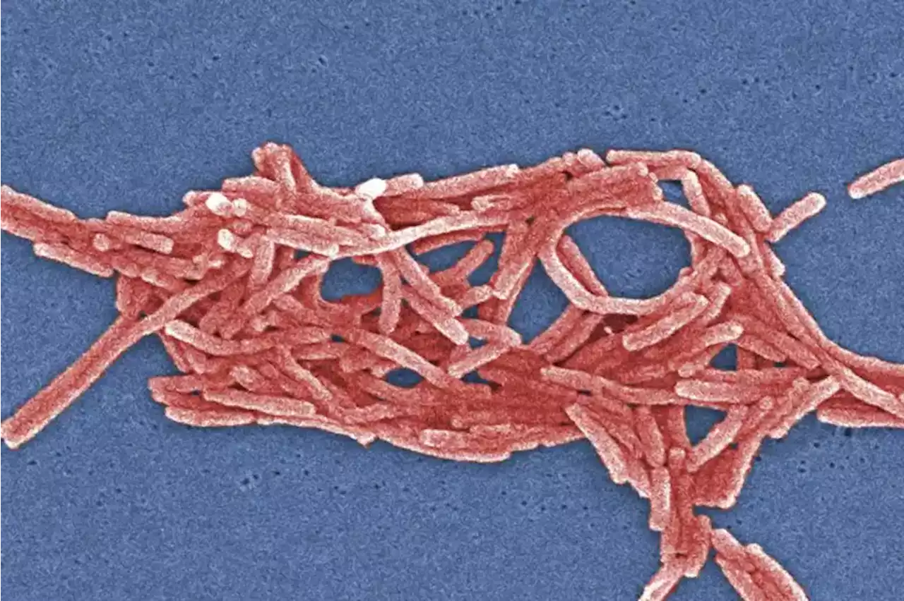 Legionnaires’ disease may be cause of mystery pneumonia in Argentina