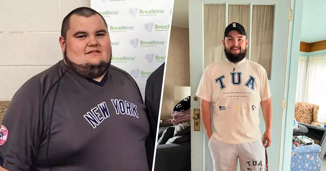 After years of extreme eating, man loses 220 pounds: 'I feel amazing'