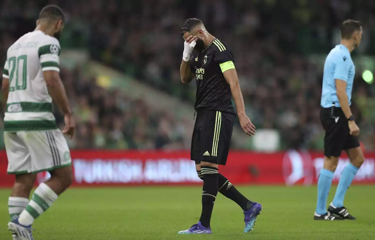 Malgré la blessure de Benzema, Le Real domine facilement le Celtic en C1