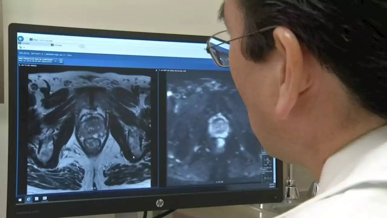 Doctors urge men to get screened during Prostate Cancer Awareness Month