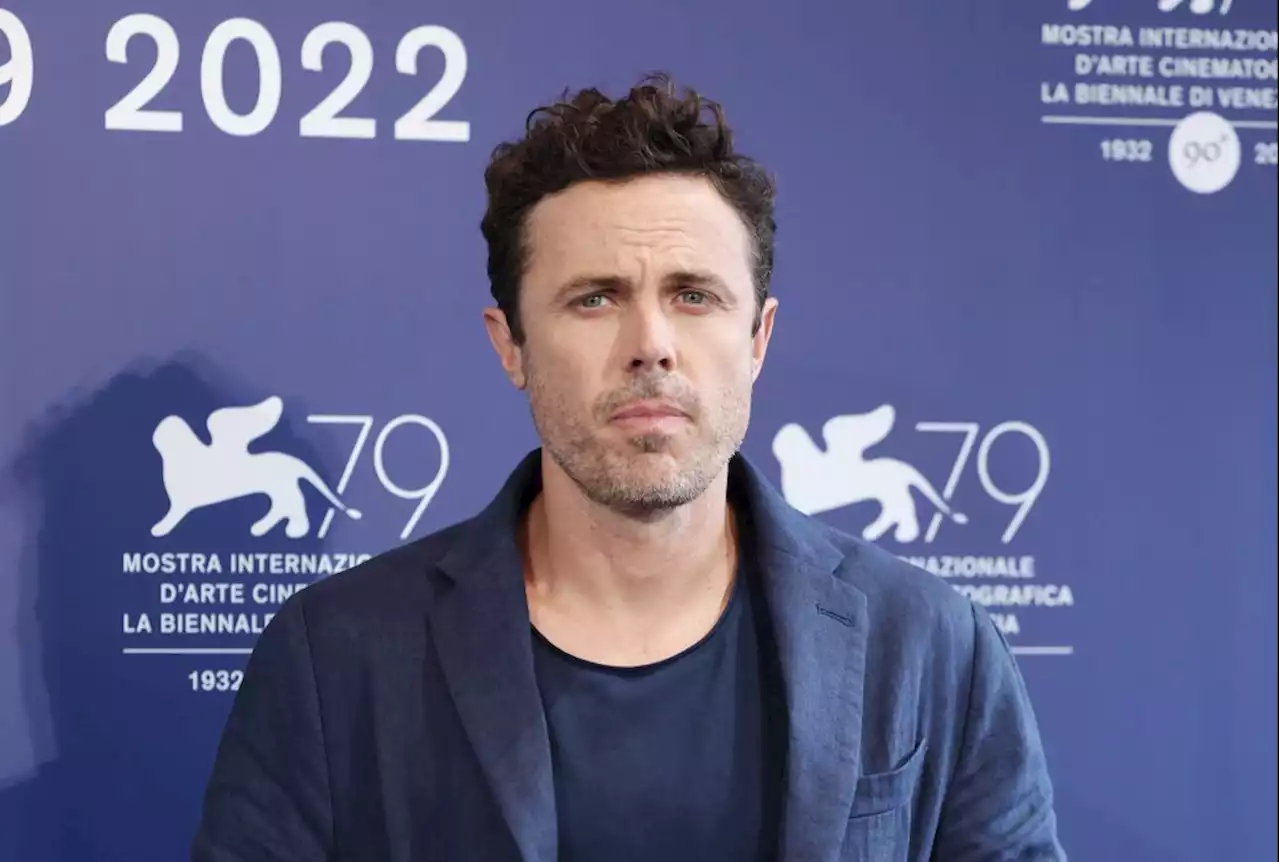 Casey Affleck: “I’ve Seen Blonde And It’s Incredible” — Venice