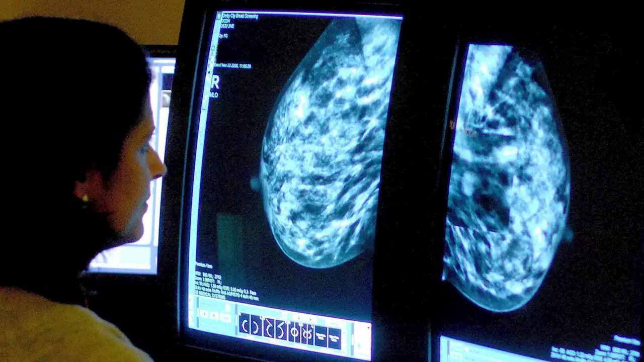 Couch potatoes 'more likely' to receive breast cancer diagnosis, experts warn