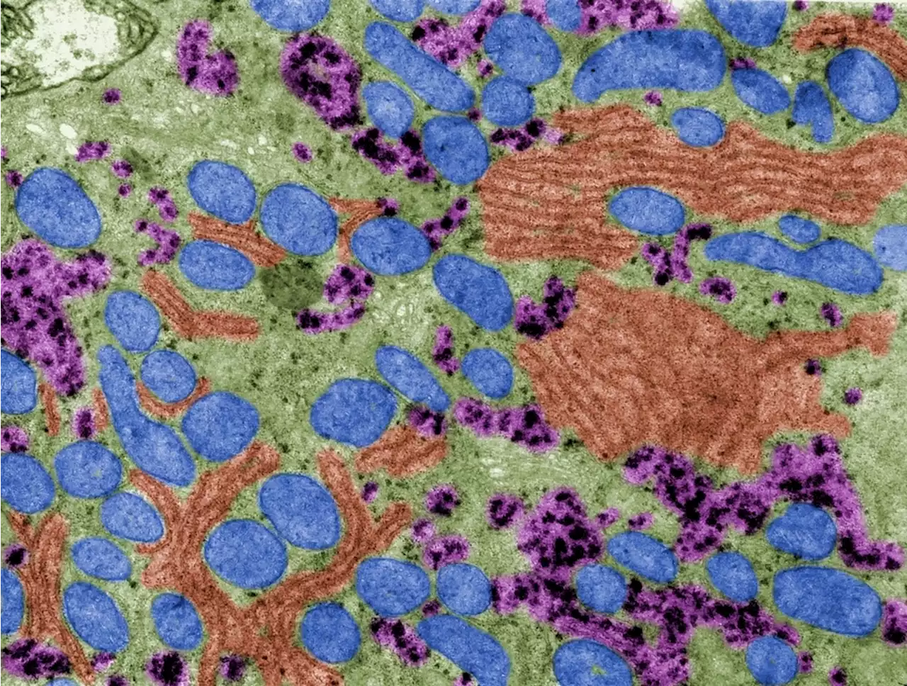 Reviewing the Fabrication of Nanopores Using TEM