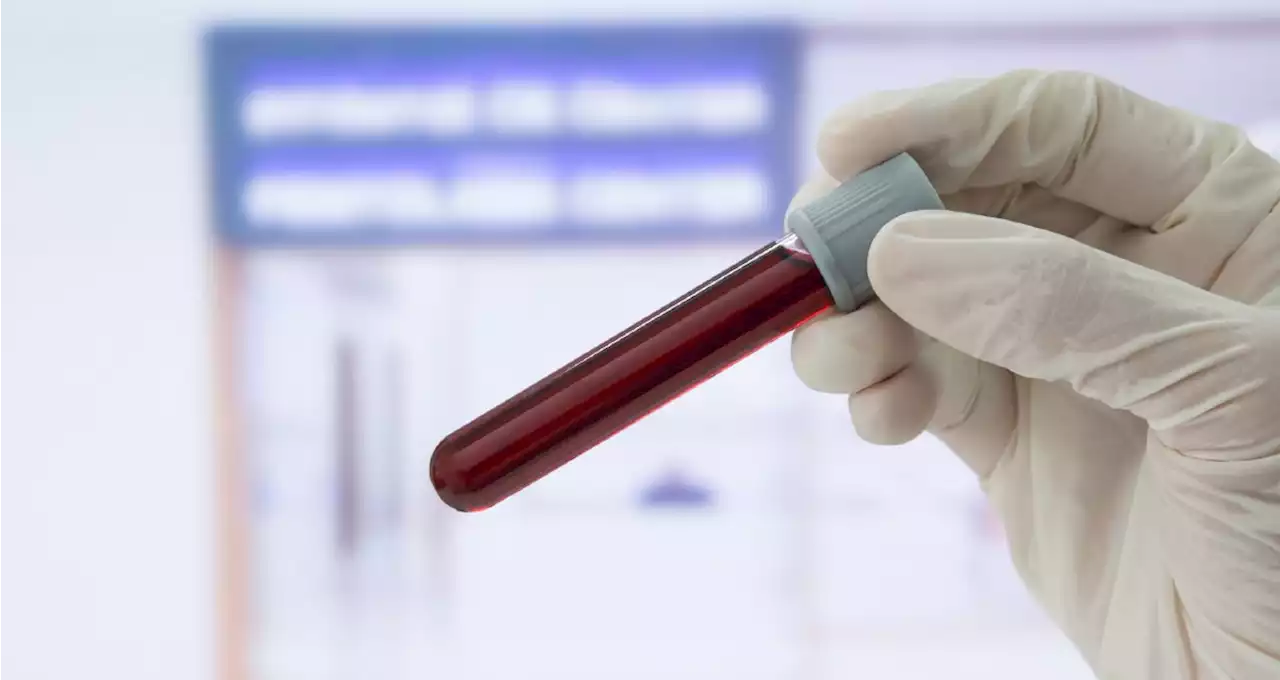 Blood Test Shows Promise for Quick Diagnosis of ALS