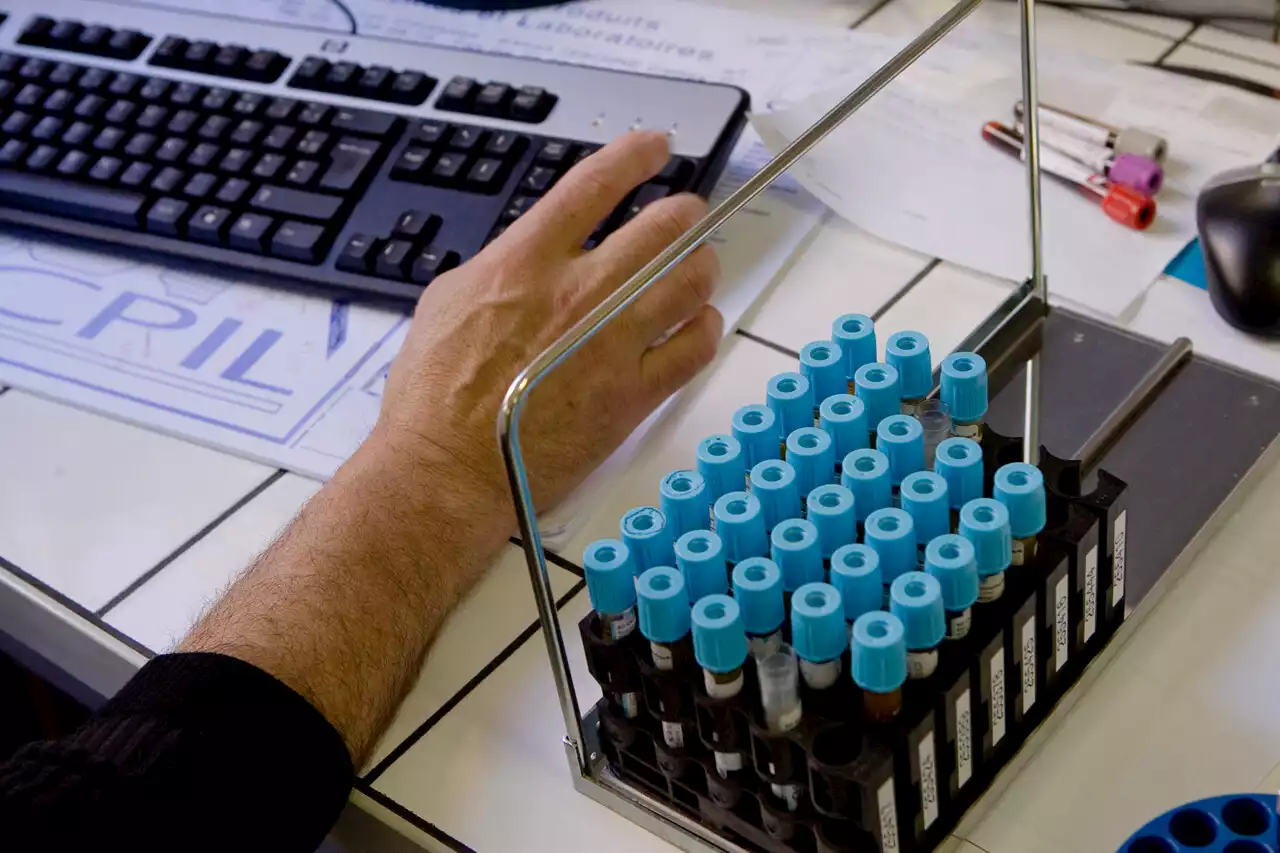 Grève des laboratoires d'analyse : un accord trouvé avec l'Assurance maladie