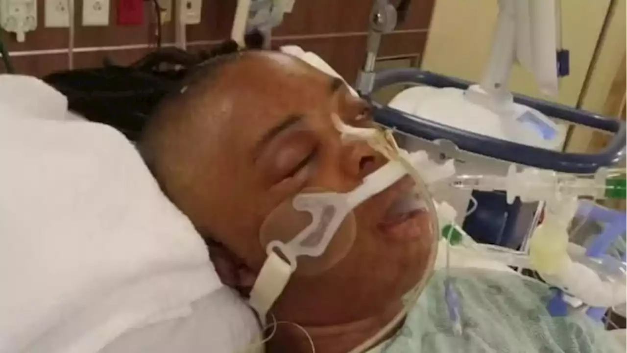 ‘I keep having flashbacks’: Family says woman still recovering after being shot in head by man she knew on Houston METRORail