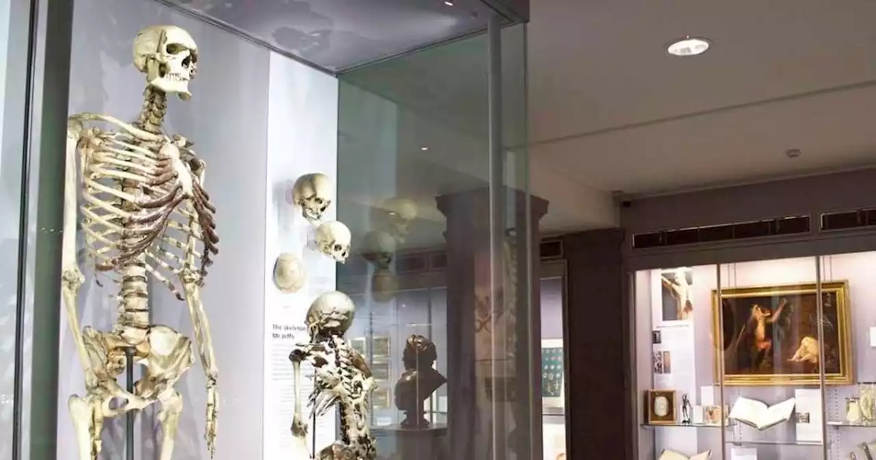 Skeleton of ‘Irish Giant’ to be removed from display at London museum