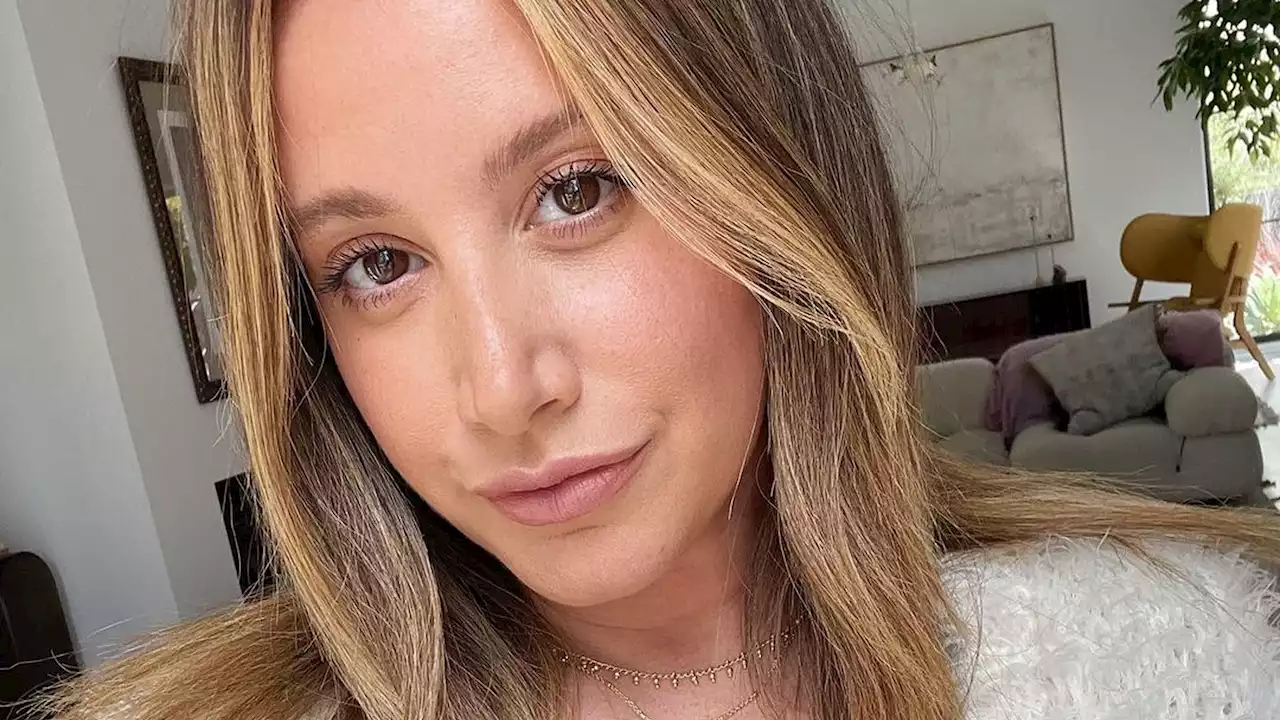 Ashley Tisdale spricht offen über ihre Alopezie-Erkrankung