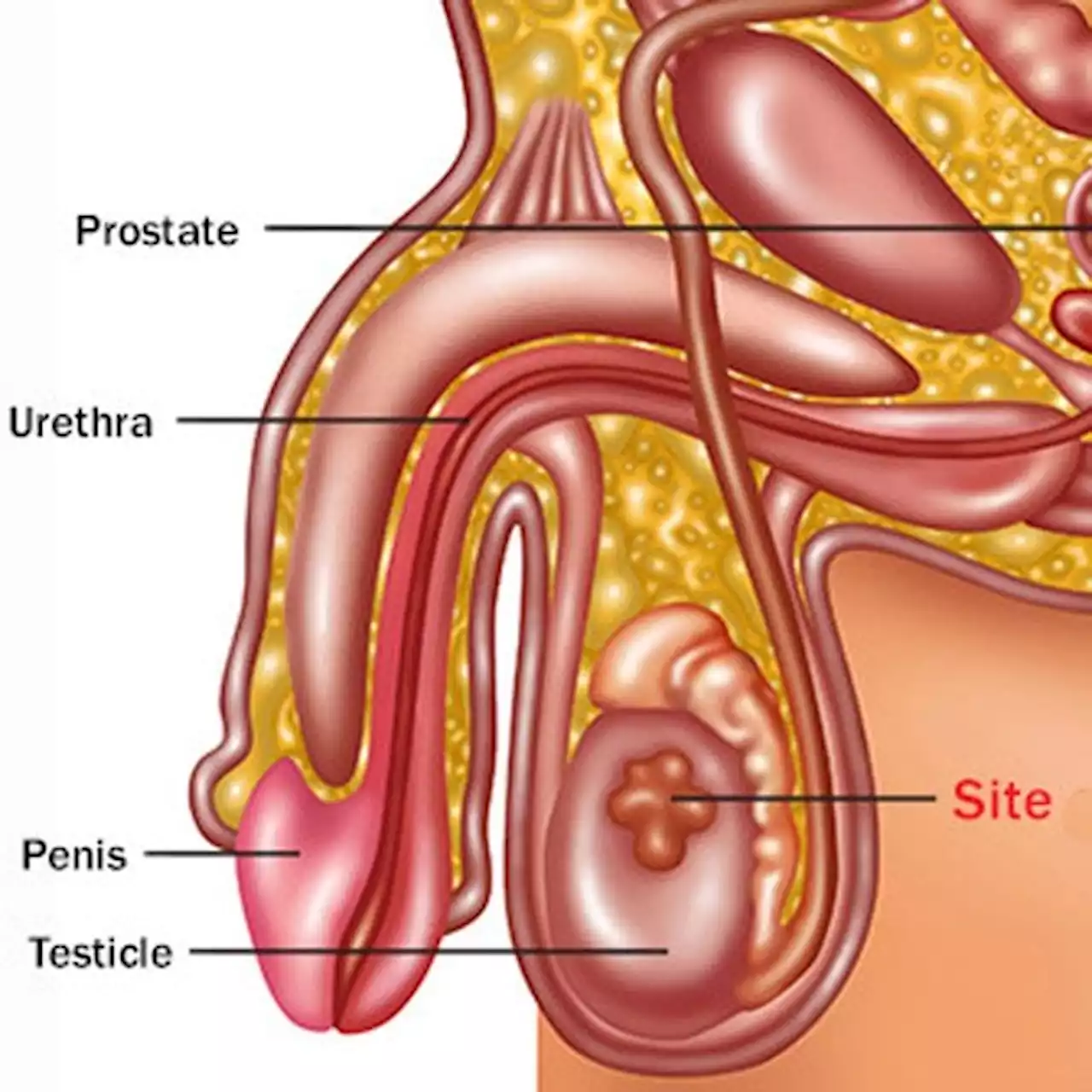 Cancer: Guide to Testicular Cancer