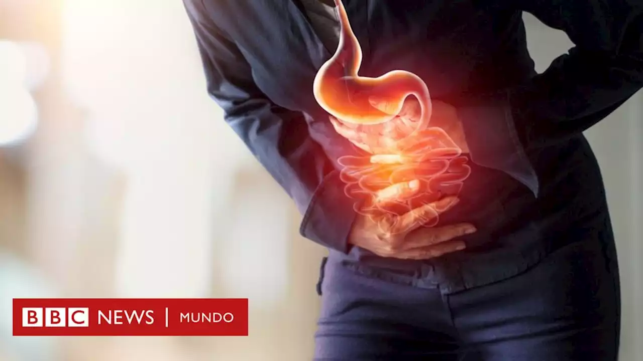 Las razones por las que te puedes sentir hinchado y cómo puedes prevenirlo - BBC News Mundo