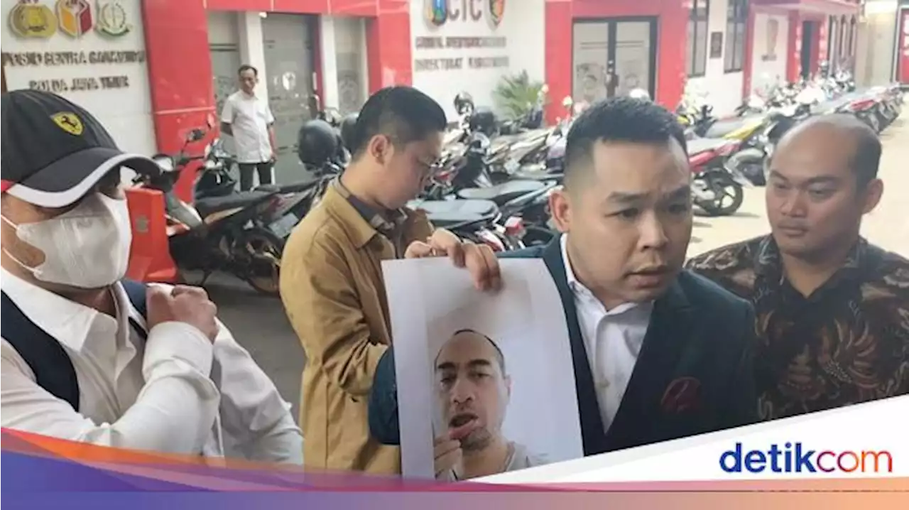 Ferry Irawan Ngaku Dicakar Venna Melinda Sebelum Berangkat ke Kota Kediri