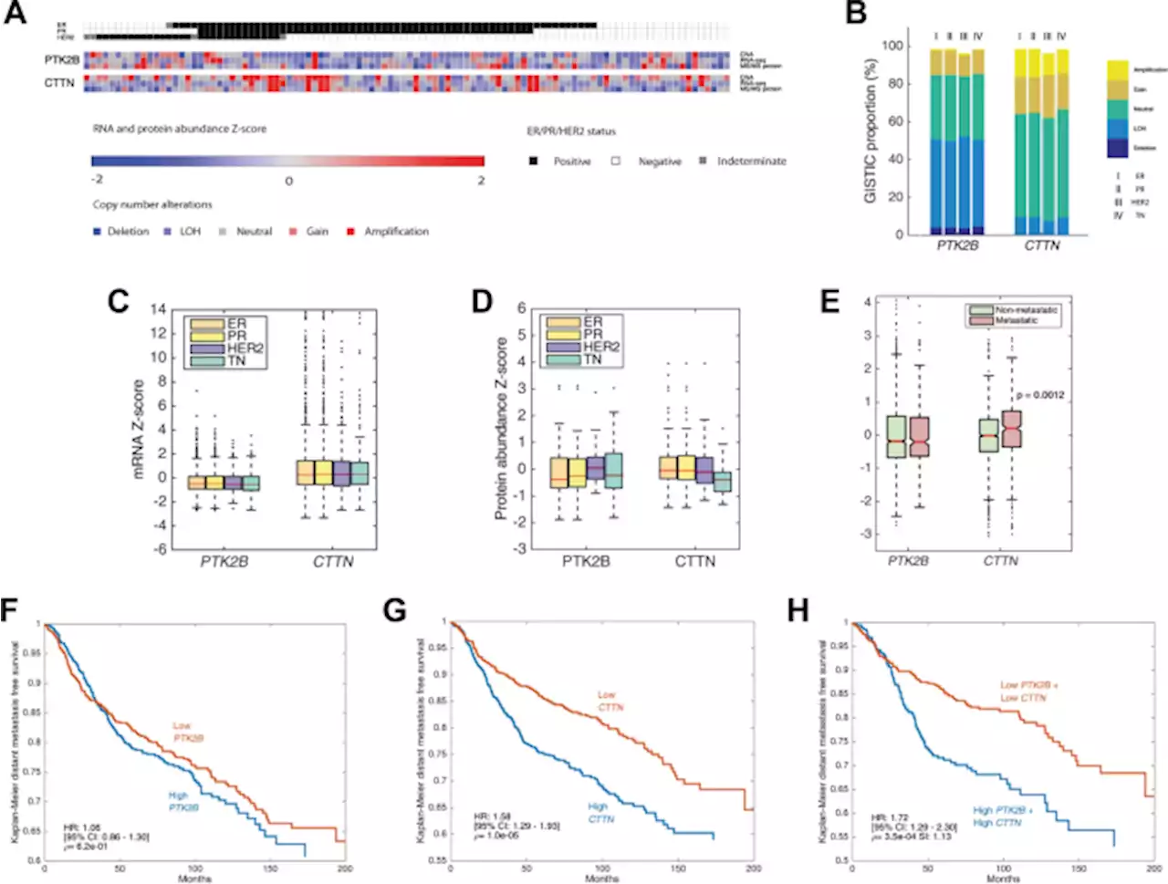 A novel Pyk2-derived peptide inhibits invadopodia-mediated breast cancer metastasis - Oncogene