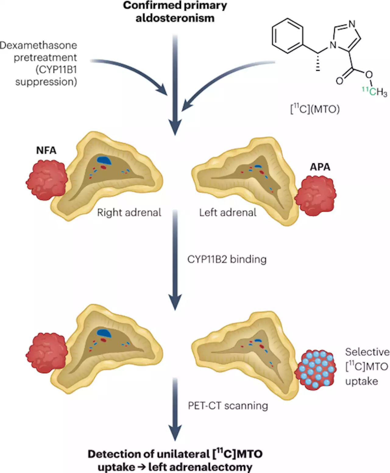 Non-invasive detection of a common, surgically correctable form of hypertension - Nature Medicine