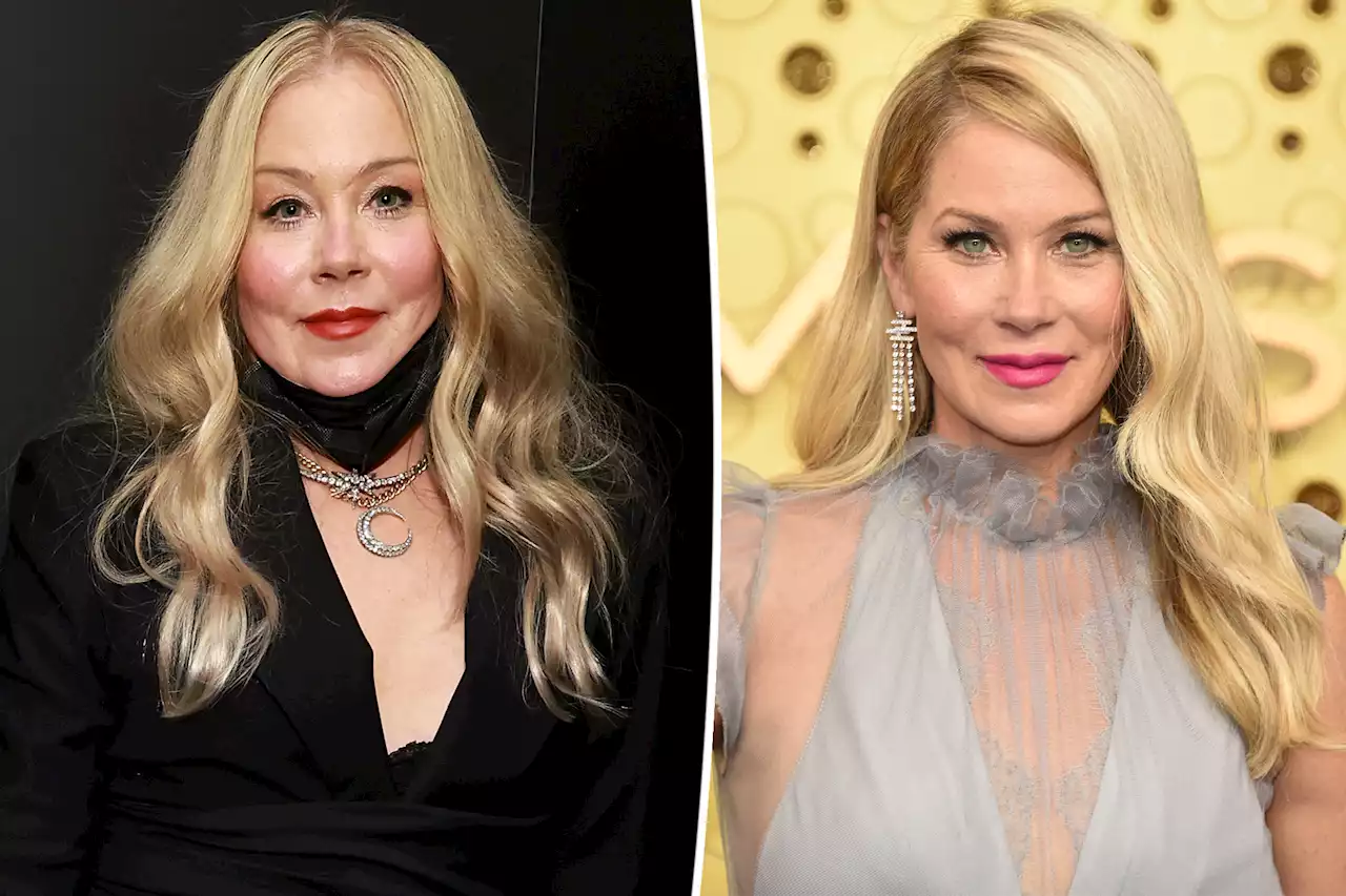 Christina Applegate slams troll saying plastic surgery changed her looks, not MS