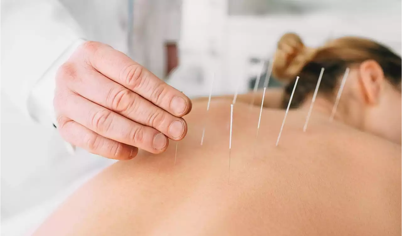 Effective and Safe Pregnancy Pain Relief: Acupuncture Shown To Ease Lower Back Pain