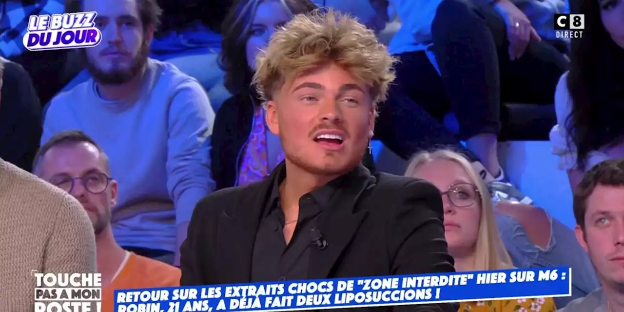 'Je me suis fait arnaquer' : critiqué sur les réseaux sociaux, Robin livre sa version des faits après son passage dans Zone Interdite sur la chirurgie esthétique (VIDEO)