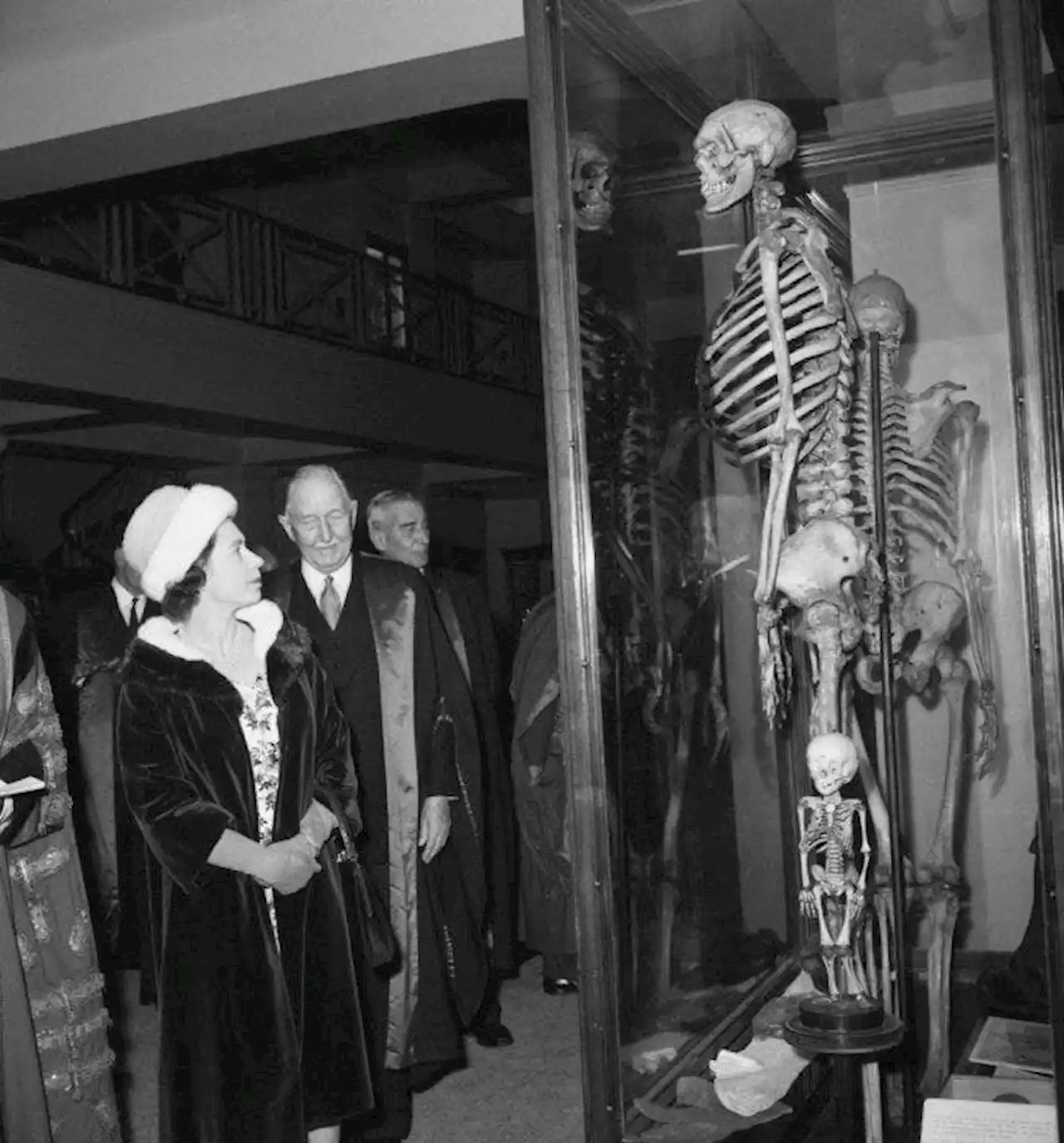 London's 'Irish Giant': Museum wants to remove controversial skeleton display