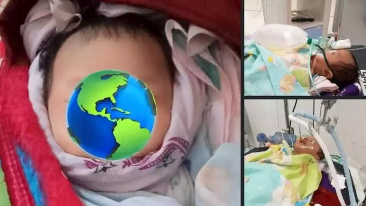 Viral Bayi 54 Hari Meninggal Usai Dicekoki Jamu, Sempat Kritis dan Infeksi Paru