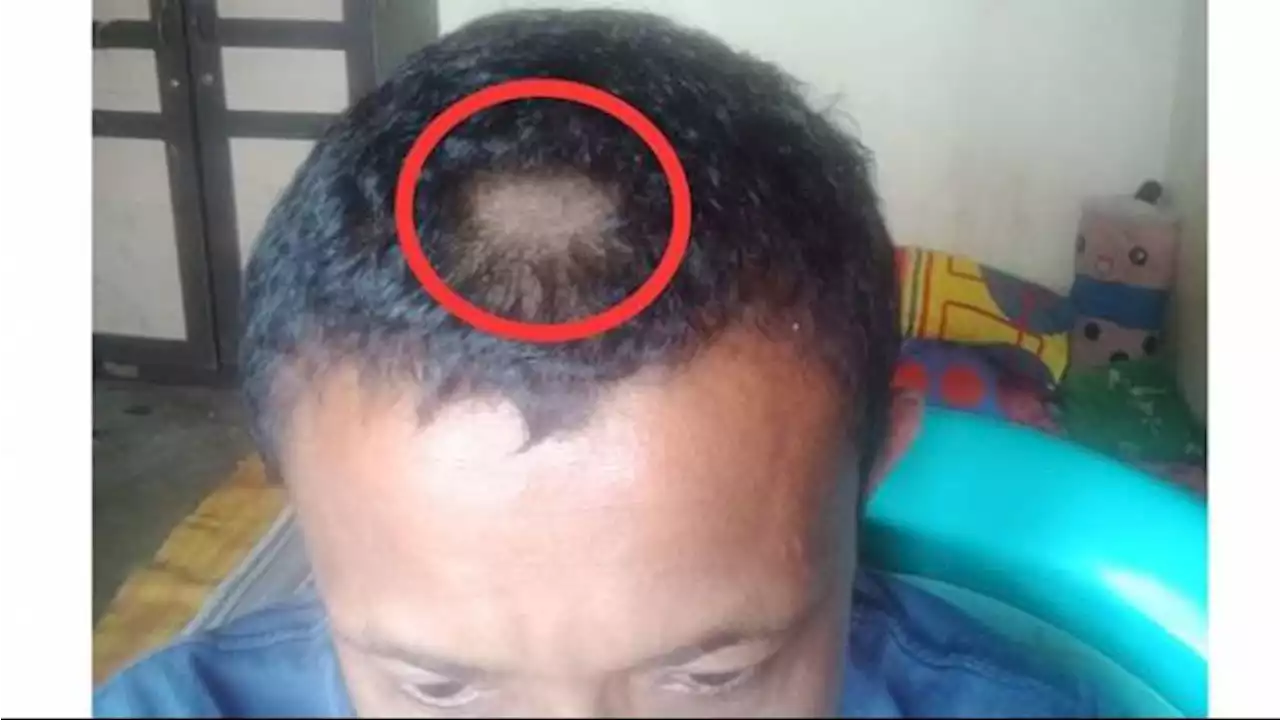 Balas Dendam Orangtua Murid saat Potong Rambut Guru, Berawal Tak Terima Rambut Anaknya Digunting