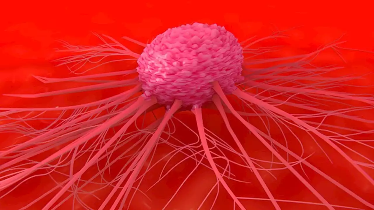 Study of Beliefs About What Causes Cancer Sparks Debate