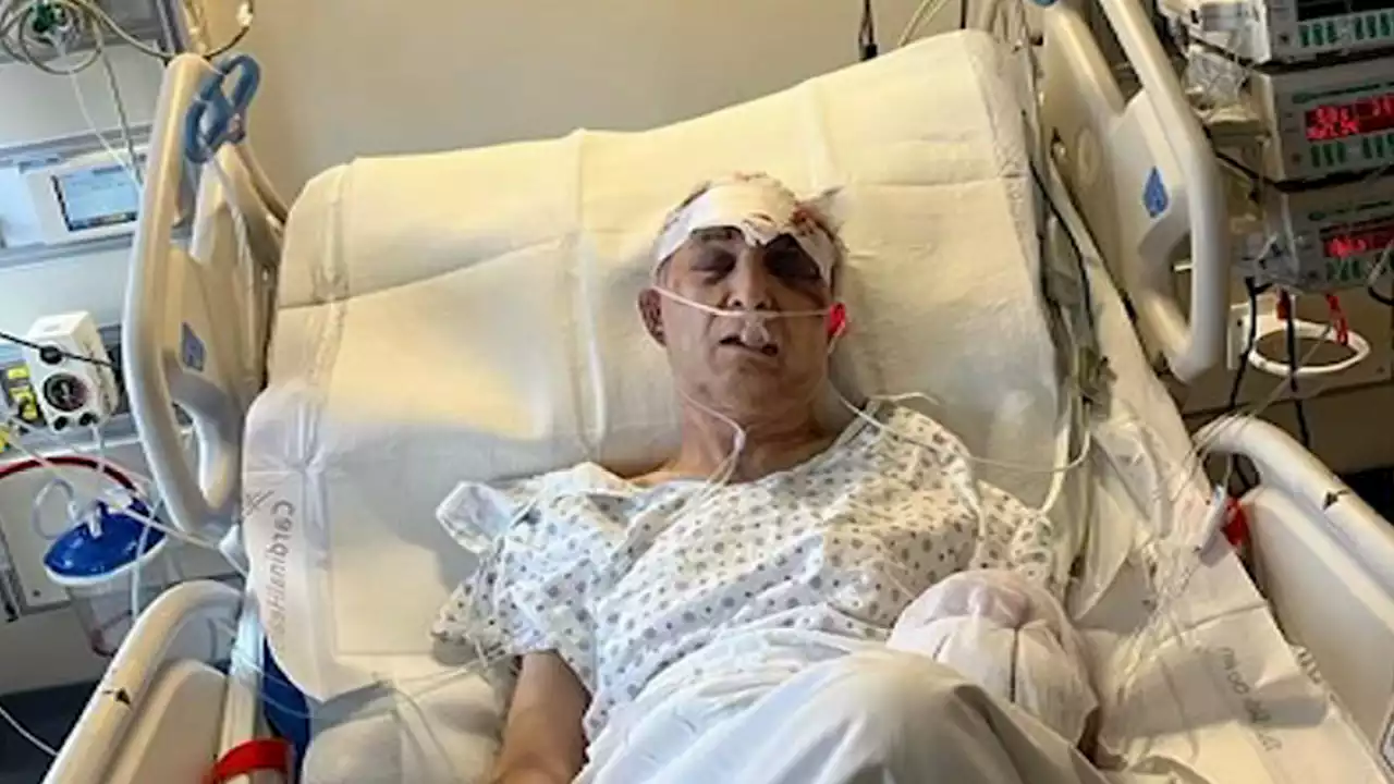 79-Year-Old NYC Jeweler Clinging to Life After $100K Robbery Beating