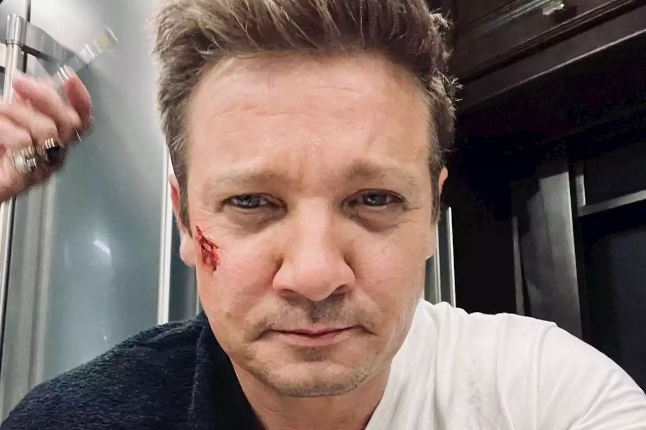 'Hawkeye' from Marvel blockbusters in critical condition in hospital | The Citizen