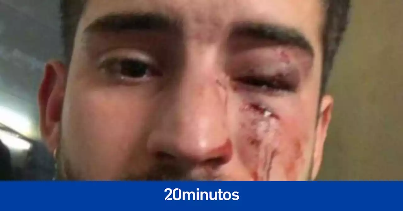 El Ayuntamiento de Barcelona, tras dictarse prisión por la brutal agresión homófoba de 2019 en el metro: '4 años son demasiados'