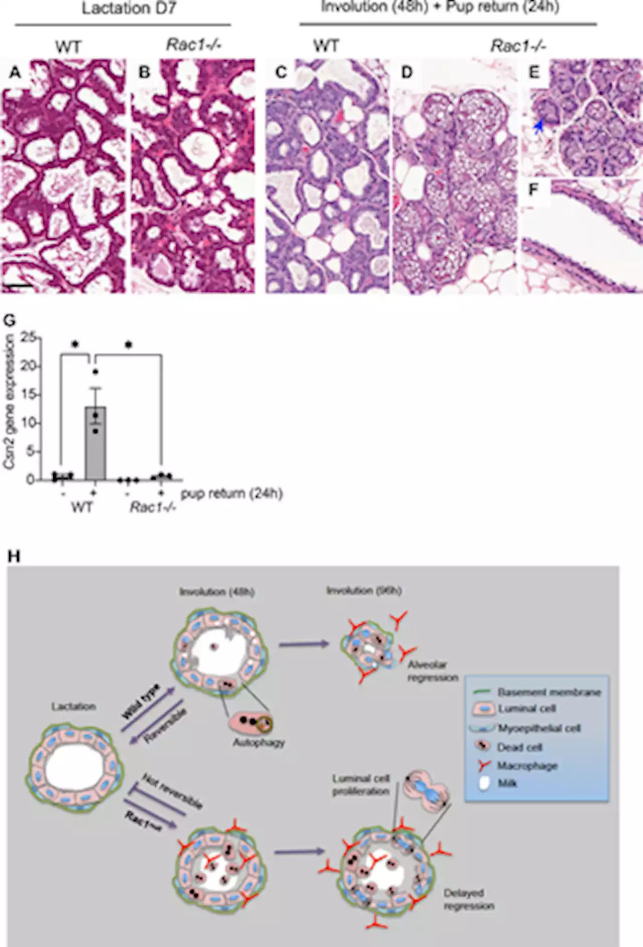 Rac1 controls cell turnover and reversibility of the involution process in postpartum mammary glands