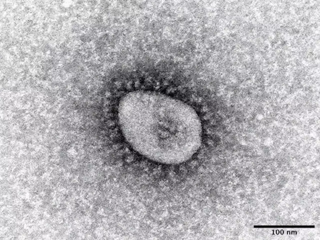 オミクロン株新系統「ＸＢＢ・１・５」、アメリカの新規感染の５割…米ＣＤＣ推計 - トピックス｜Infoseekニュース