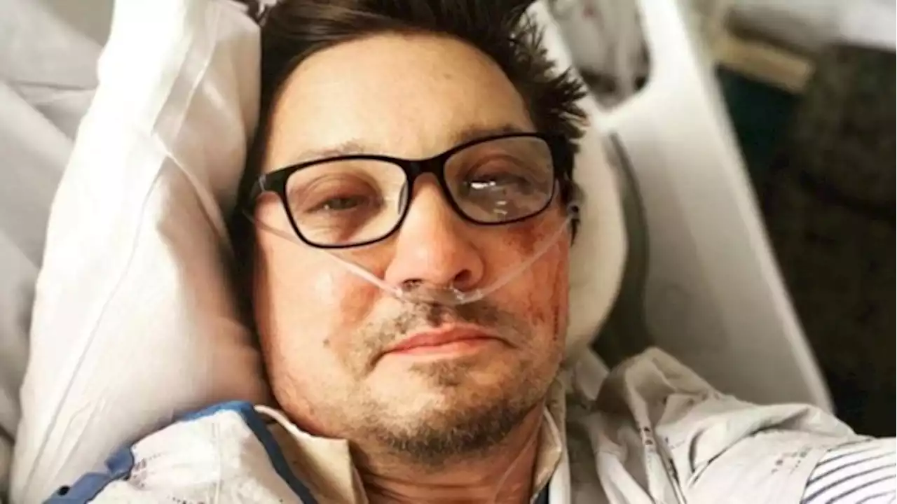 Jeremy Renner revela que se fracturó 30 huesos y comparte imagen de su rehabilitación | Tomatazos