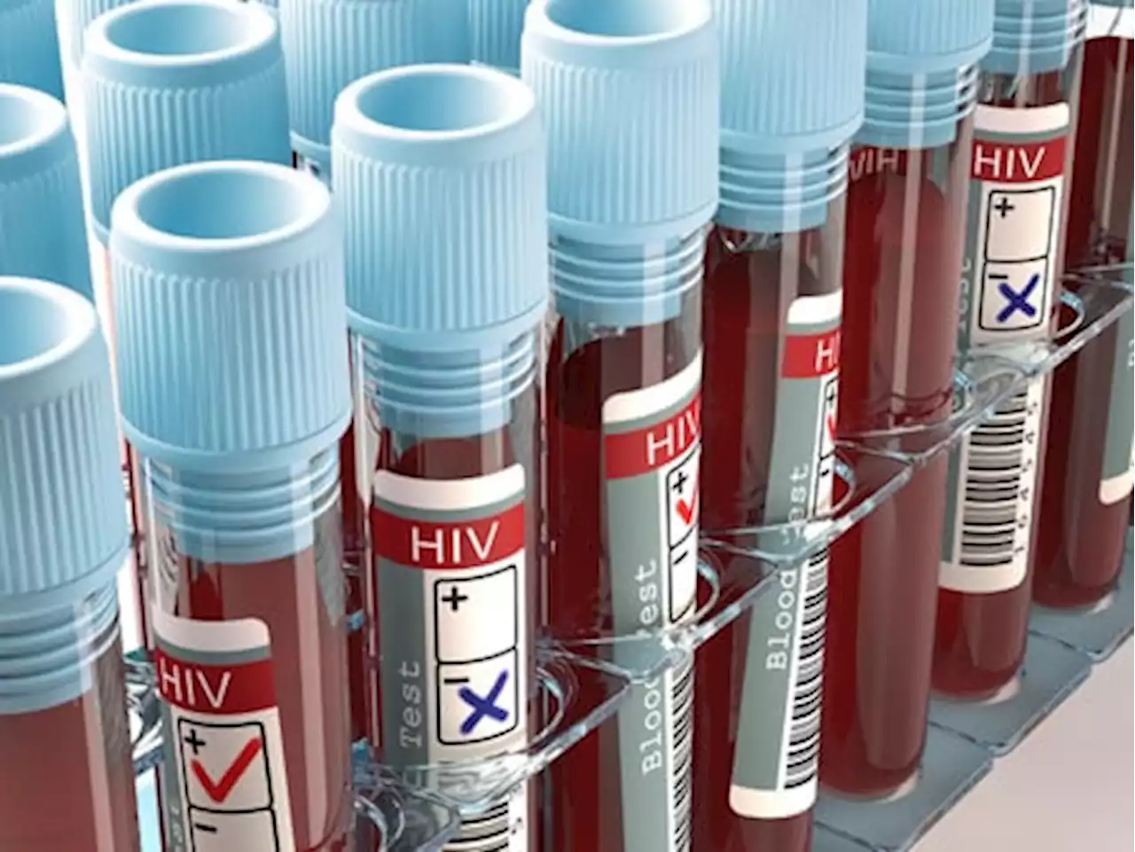 NGO vows to reduce HIV/AIDS epidemic in South-East