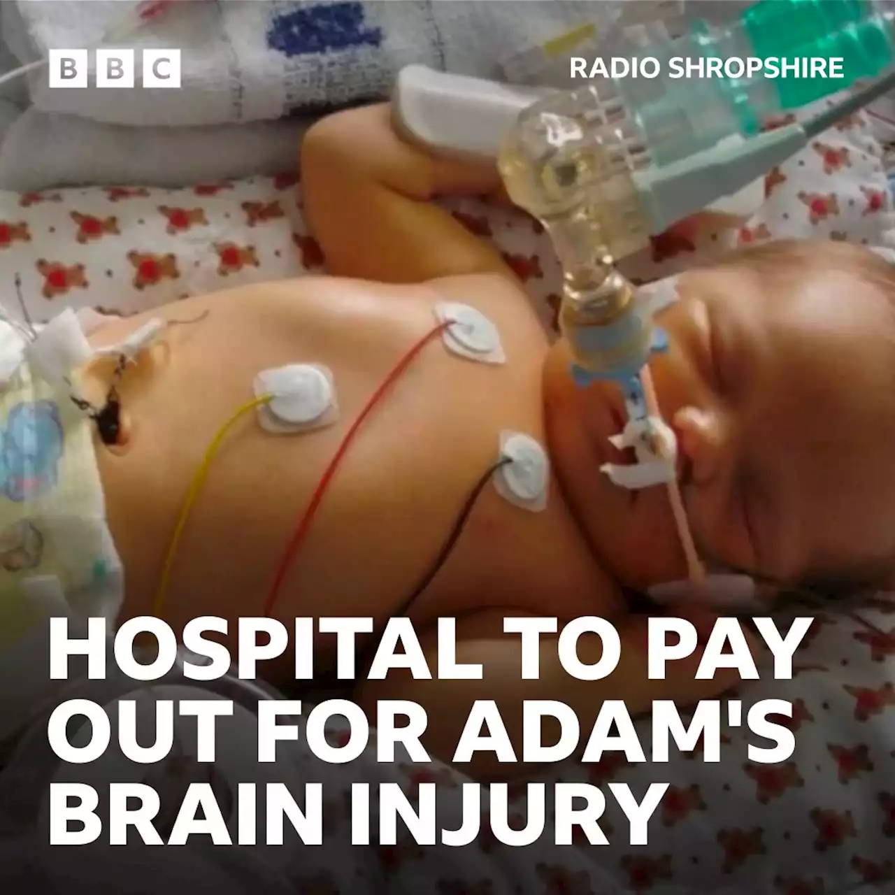 Shrewsbury maternity scandal: Payout over boy's brain injury