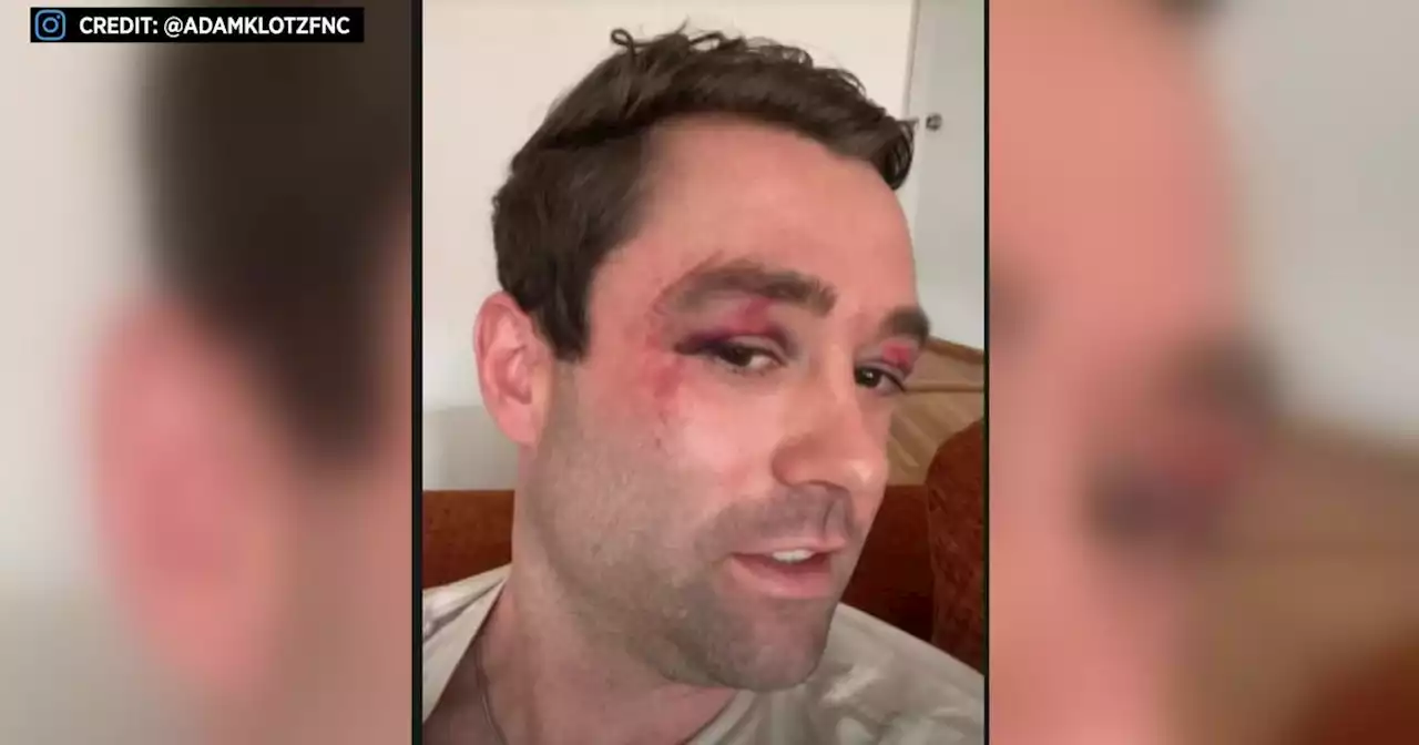 TV meteorologist Adam Klotz says he was attacked by a group of teens on subway in Chelsea